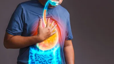 Ilustrasi Asam Lambung Naik