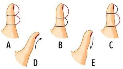 Illustrasi Tes Kepribadian