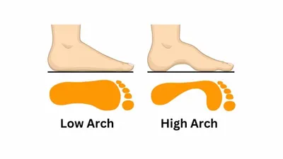 Mengenal Kepribadian Seseorang dari Bentuk Lengkungan Telapak Kaki, Sosok Karismatik Ternyata Tipe yang Ini (Jagran Josh)