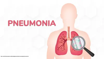 Kemenkes mengimbau masyarakat kembali disiplin memakai masker menyusul adanya temuan kasus pneumonia di DKI Jakarta.