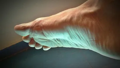 Ternyata jempol kaki menyimpan berbagai fakta menarik dan mitologi yang telah ada sejak zaman dahulu. Berikut adalah mitos dan faktanya.