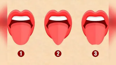 Tes Kepribadian: Ungkap Karaktermu dari Bentuk Lidah, Cek Kamu yang Mana?
