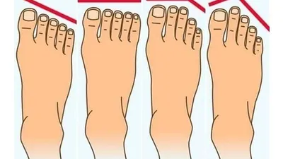Bentuk kaki bisa ungkap kepribadian seseorang