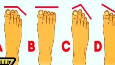 Bentuk Jari Kaki dan Kepribadian Seseorang