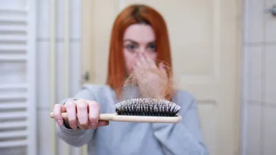 Illustrasi.Rambut rontok