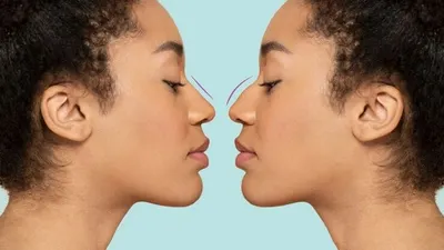 Ilustrasi Kepribadian Seseorang Berdasarkan Bentuk Hidung yang Dimiliki.
