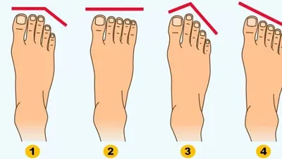 Tes kepribadian bentuk jari kaki
