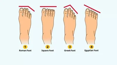 Kenali Tipe Karaktermu yang Dominan Berdasarkan Bentuk Kaki, Kamu yang Mana?