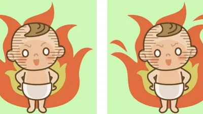 Tes IQ: Temukan 3 Perbedaan dari Gambar Bayi Ini