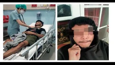 Korban Penganiayaan Anak Perwira Polisi Polda Sumut 