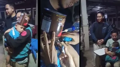 Potret Wafer Nyangkut di Kepala Balita