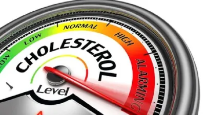 Cara Aman dan Tepat Turunkan Kadar Kolesterol Tinggi Dengan Cepat, Simak Berikut Ini Penjelasannya!