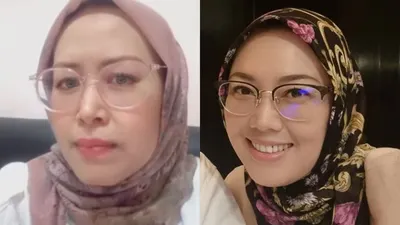 Anne Ratna Mustika Kena Sindir Usai Bongkar Aib Dedi Mulyadi Lewat Pidato: Bupati Harusnya Begini!
