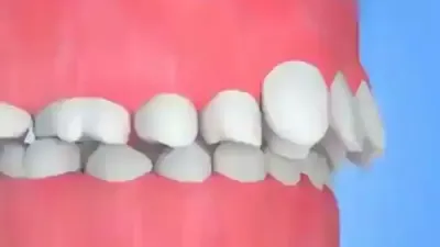 Sakit Gigi saat Puasa