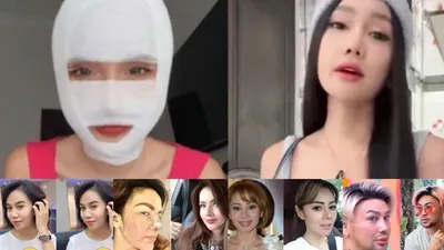Kaleidoskop 2022: 5 Deretan Artis yang Lakukan Operasi Plastik Sepanjang 2022, Ada yang Sampai Ganti Kepala