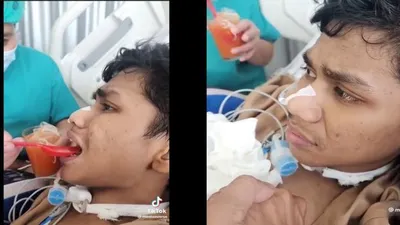 Kondisi David Ozora korban penganiayaan oleh Mario Dandy kini mengalami kemajuan