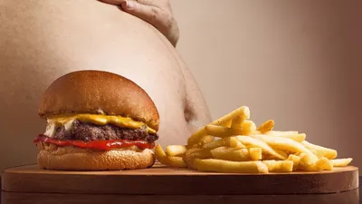 Illustrasi. Obesitas