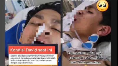 Update Keadaan David Korban Kasus Penganiayaan 