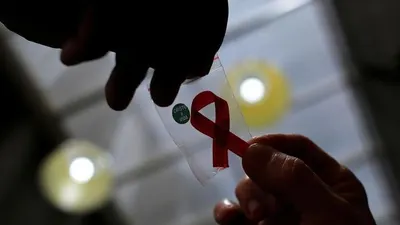 HIV AIDS