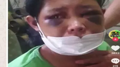 Viral! Dugaan Kasus Penganiayaan ART di Bandung, Hotman Paris Minta Kasus Ditarik ke Polda Jabar!