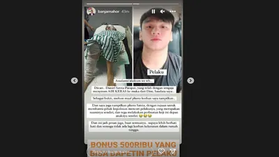 Kembali Terjadi! KDRT Suami Siram Istri dengan Air Keras di Bandung Barat