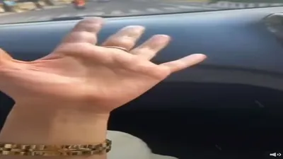 Curhatan Seorang Wanita yang Alami Hiperhidrosis, Tangannya Selalu Basah Bahkan Menetes hingga Bingung Bila Mau Salaman/ @nyinyir_update_official