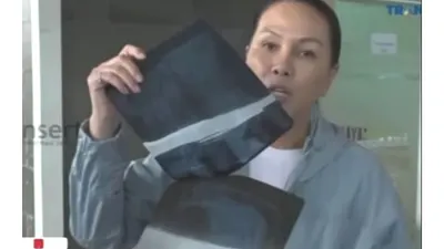 Warganet Tuding Nikita Mirzani Masuk RS Hanya Muslihat Semata, Fitri Salhuteru Ungkap Bukti Rontgen Sahabat