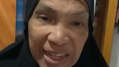 Artis senior Dorce Gamalama yang tengah sakit. 