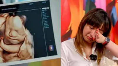 Ilustrasi: Semakin Berani, Denise Chariesta Kini Pamer Foto USG dengan Selingkuhannya Pria Berinisial RD