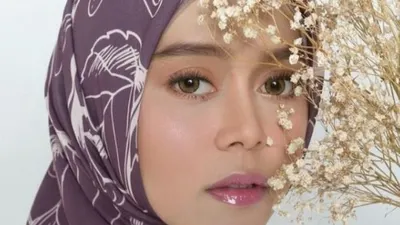 Terkuak Kondisi Terkini Lesti Kejora Usai Diduga Mendapat KDRT dari Rizky Billar