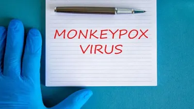 Penularan, gejala, dan pencegahan monkeypox atau cacar monyet.