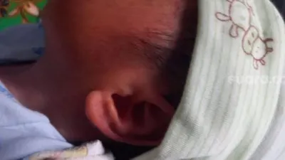 Muhamad Aftar Rifaldo, bayi pasangan Ahmad Nazri dan Suraeda, memiliki kuping berbentuk mirip lafadz Allah saat ditemui di rumahnya di Poris Gaga, Cipondoh, Kota Tangerang, Selasa (2/3/2021). [Suara.com/Muhammad Jehan Nurhakim]