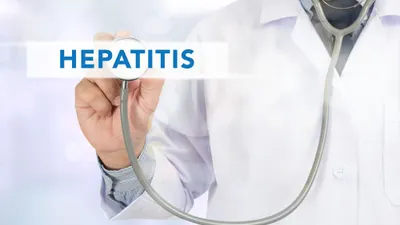Ilustrasi Hepatitis Akut.
