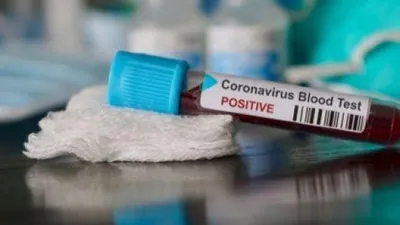 Jumlah Spesimen Tes Corona 40.979, Kasus Positif Covid-19 di Indonesia Bertambahh 3.356 Kasus (Update 4 November 2020)