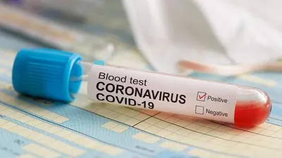 UPDATE COVID-19 DKI JAKARTA: Kasus Harian Turun Tajam, Terendah Sejak Akhir Agustus