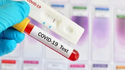 Update Covid-19 Kota Bogor: Pasien Sembuh Bertambah 4