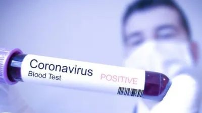 Ilustrasi virus corona