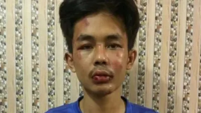 Alpin Andria, pelaku penyerangan terhadap Syekh Ali Jaber/ dok