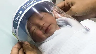 Bayi menggunakan face shield (Paolo Hospital Samutprakarn via AP)