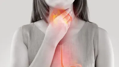 Ilustrasi pengidap GERD (klikdokter/Emily Frost/shutterstock)