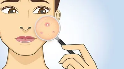 Ilustrasi  (depositphotos.com)