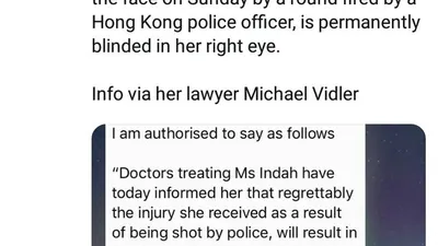 Wartawati yang Tertembak di Hong Kong Alami Kebutaan di Mata Kanan