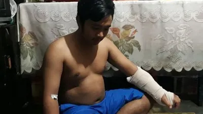 M Rian (20), pemuda Tebet korban pembacokan saat terjadi keributan warga di kawasan Kampung Melayu Besar, Kebun Baru. (Suara.com/Bagaskara).