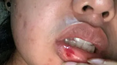 WA, korban kekerasan dalam rumah tangga oleh oknum anggota DPRD Tanjungpinang (dok pribadi)