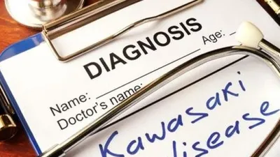 Penyakit yang diakibatkan virus Kawasaki. (Shutterstock)
