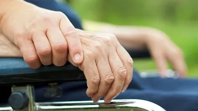 Ilustrasi pengidap parkinson (Alodokter)