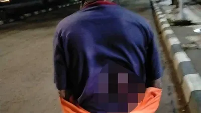 Luka di tubuh Suminan yang menjadi korban perampokan bersenjata motor dan ponselnya di Jalan Letjen Suprato, Cempaka Putih, Jakarta Pusat, pada Rabu (26/2/2020) lalu. (Instagram)