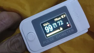 Pulse Oximeter, alat pengukur saturasi oksigen dalam darah yang penting dimiliki pasien Covid-19 saat isolasi mandiri (Ayojakarta/Firda)