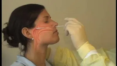 Sebagai ilustrasi, cara menguji Covid-19 menggunakan teknik swab hidung (YouTube/The New England Journal of Medicine)