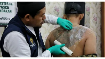GRATIS! Baznas Bazis DKI Jakarta Gelar Program Roadshow Hapus Tato di Bulan Ramadan, Catat Lokasi dan Jadwalnya